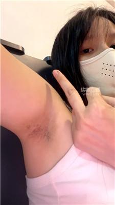 【兔牙】腋下口水    251125-16